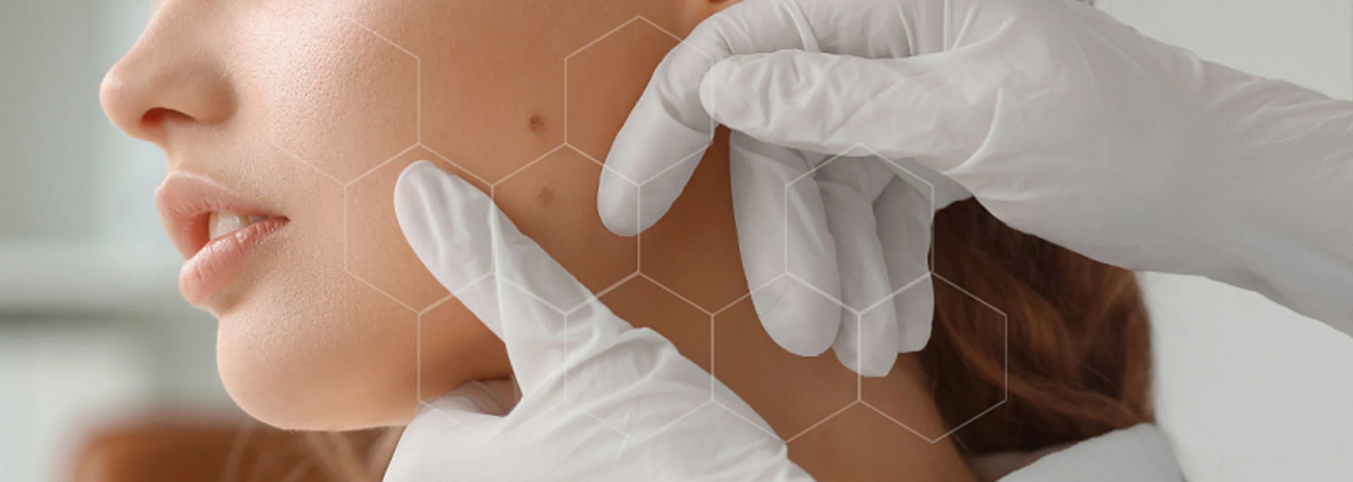 Dermatology